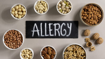 SANP0003 Alergias e intolerancias alimenticias (trabajadores del sector HOSTELERÍA Y TURISMO) (TELEFORMACIÓN)